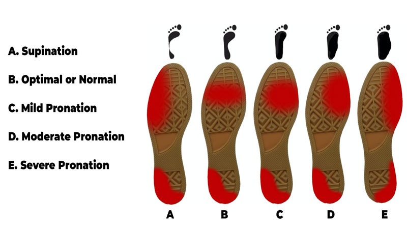 Down and dirty differences between pronation vs supination? - Foot