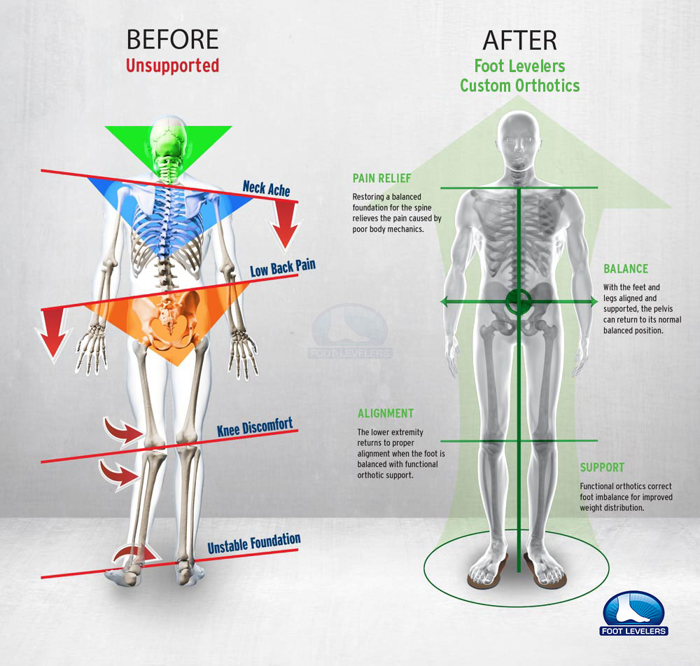 low back pain correction infographic